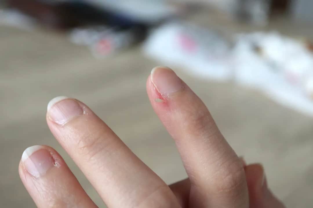 Jak zmiękczyć skórki przy paznokciach domowe sposoby, które działają Jak zmiękczyć skórki przy paznokciach domowe sposoby, które działają