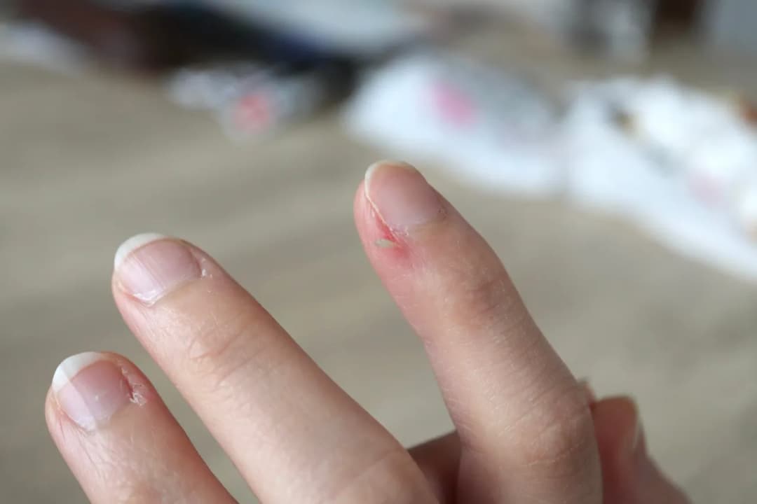 Jak zmiękczyć skórki przy paznokciach domowe sposoby, które działają Jak zmiękczyć skórki przy paznokciach domowe sposoby, które działają