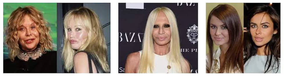 Jak pozbyć się botoksu? Sprawdzone sposoby na skutki uboczne