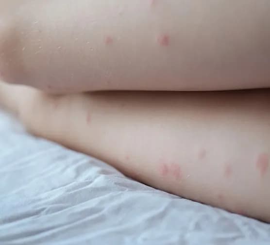 Dlaczego po goleniu nóg mam czerwone kropki i jak ich uniknąć