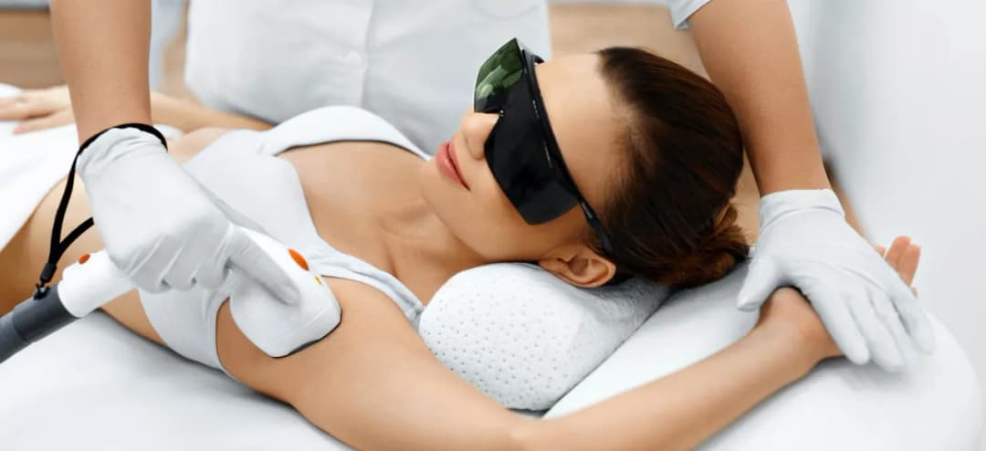 Epilacja laserowa jaki laser wybrać dla najlepszych efektów?